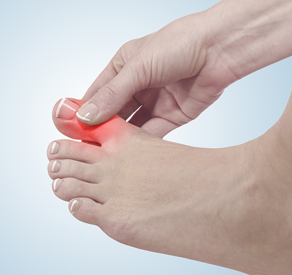 The Foot and Ankle Center of Kirkland | Fungal Nails, Filler Injection and Corns and Calluses